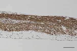 Mitsui Chemicals’ InnoCell P-Type plates for organoid-based drug discovery