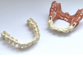 Evonik introduces two PEEK grades for long-term dental prosthetics